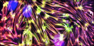 Ізраїльський стартап досяг такої реалістичності лабораторного м’яса, що його не відрізнити від фермерского